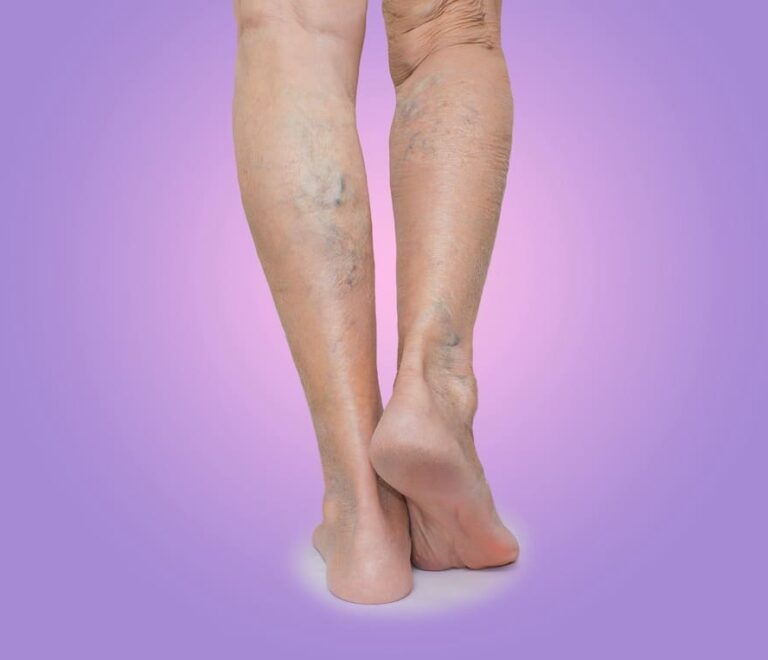 Blood and Vein circulation in the Legs and Feet