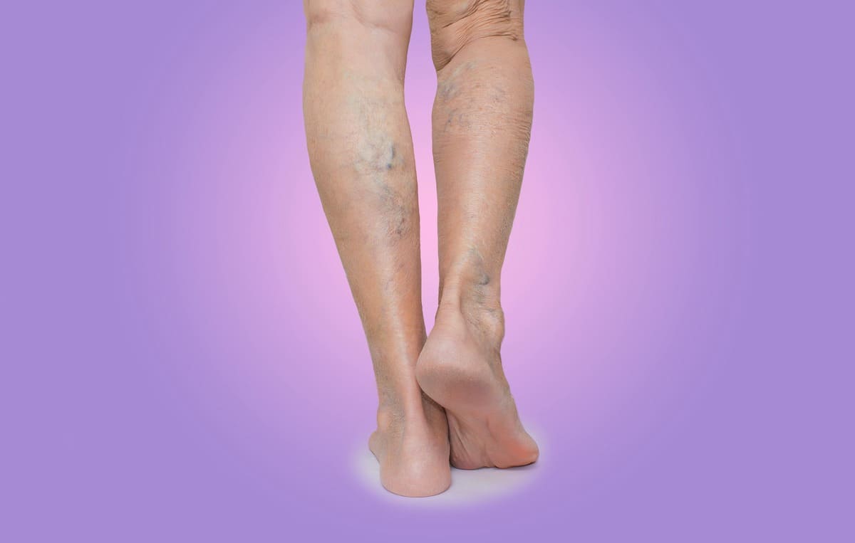 Blood and Vein circulation in the Legs and Feet